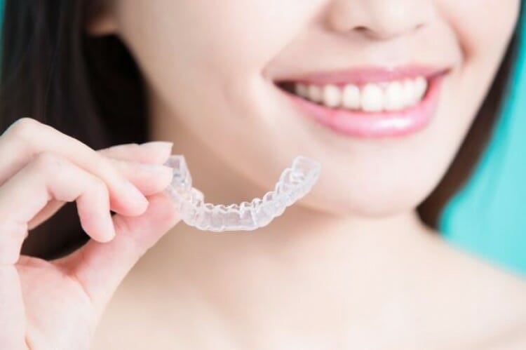 Como Funciona O Alinhador Dental Transparente Alternativa Para Quem