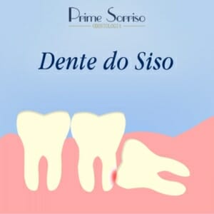 Ortodontia pode resolver DTM? - Dentista em Foz do Iguaçu - Aparelho  Ortodôntico - Facetas - Implantes - Próteses - Prime Sorriso Odontologia