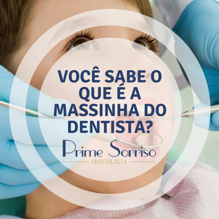 Voce Sabe O Que E A Massinha Do Dentista Dentista Em Foz Do Igua U Aparelho Ortod Ntico