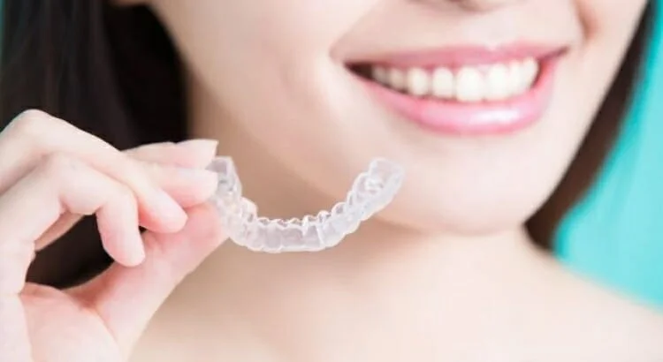 Como funciona o alinhador dental transparente? Alternativa para quem não  quer chamar atenção com o uso do aparelho corretivo. - Dentista em Foz do  Iguaçu - Aparelho Ortodôntico - Facetas - Implantes 