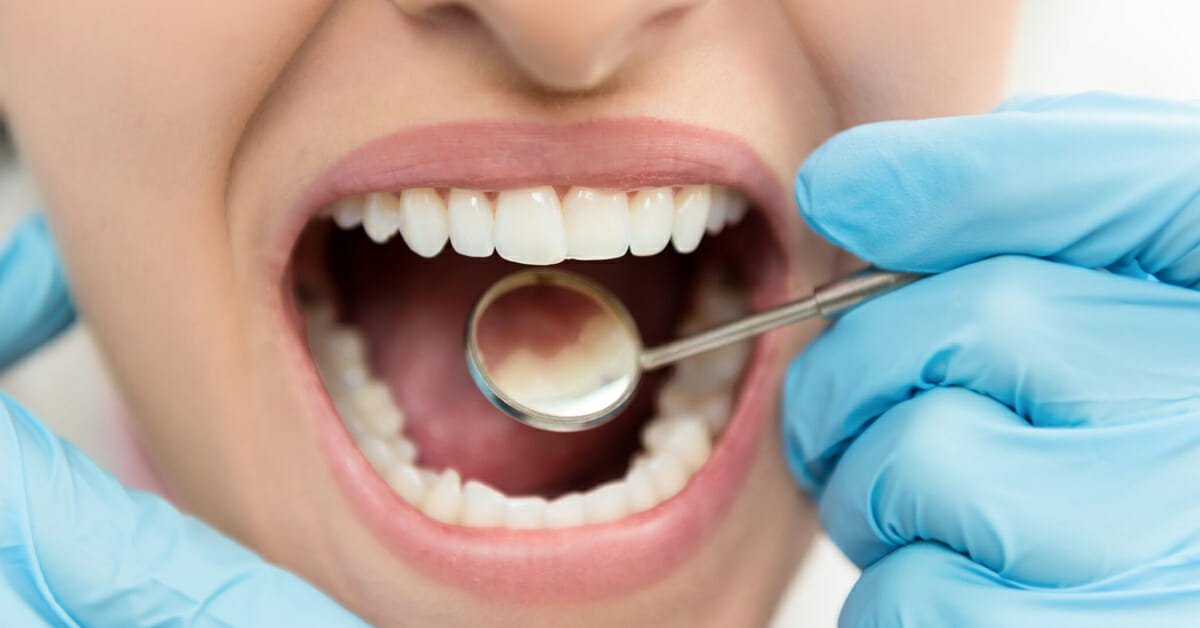 Caries Dentarias Dentista Em Foz Do Igua U Aparelho Ortod Ntico Facetas Implantes